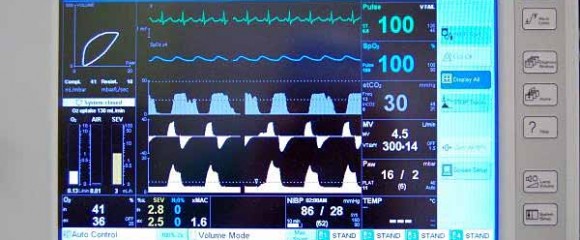 Anesthesia Monitors